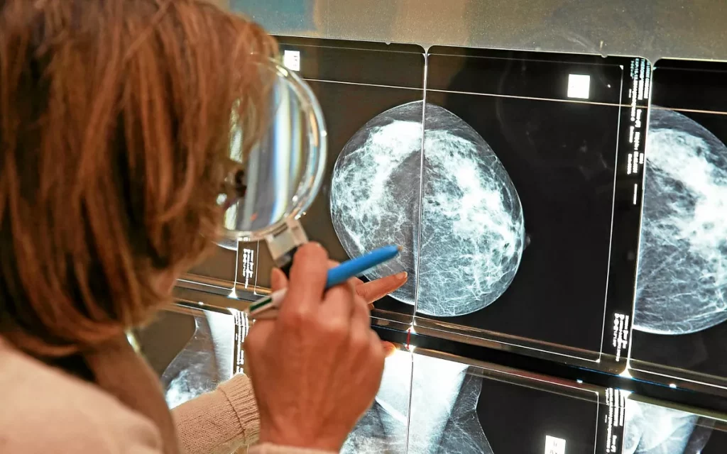 Traitement des tumeurs : l'espoir des vaccins contre le cancer