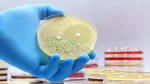 Épidémies de peste