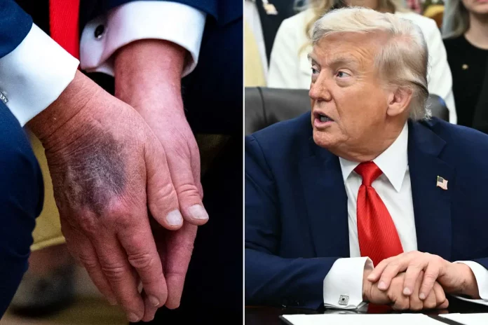 Les rumeurs sur la santé de Trump persistent malgré les démentis