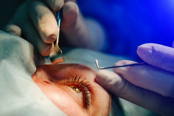 Santé visuelle : 50 % des patients atteints de cataracte privés de chirurgie